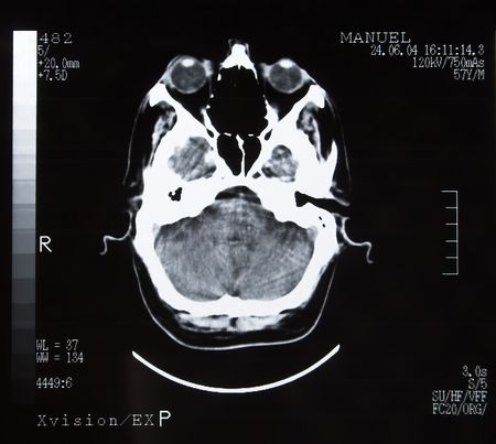 Brain Tomographyの写真素材