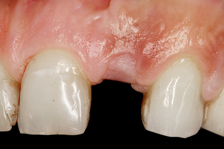dental careの写真素材