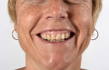 detail of the face of a fifty year old woman