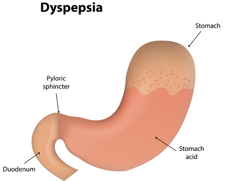 Dyspepsiaのイラスト素材