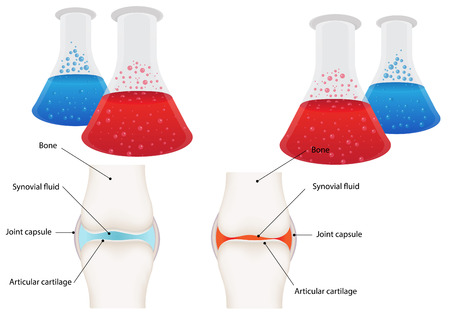 Arthritis Researchのイラスト素材