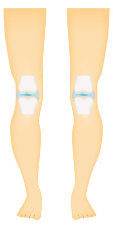 Knee Synovial Jointのイラスト素材