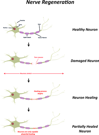 Nerve Regeneration Illustrationのイラスト素材