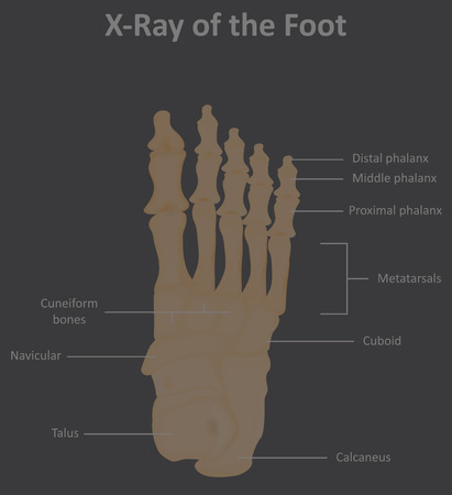 X Ray of the Foot Bonesの写真素材