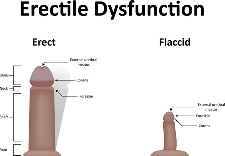 Erectile Dysfunctionの写真素材