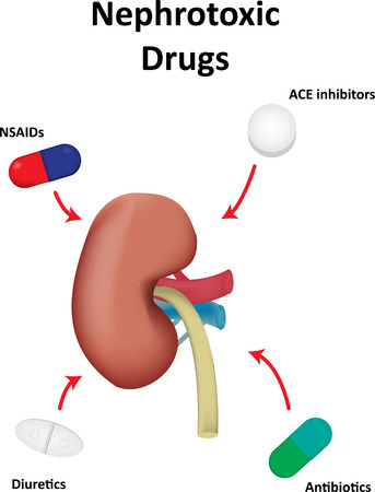 Nephrotoxic Drugsのイラスト素材