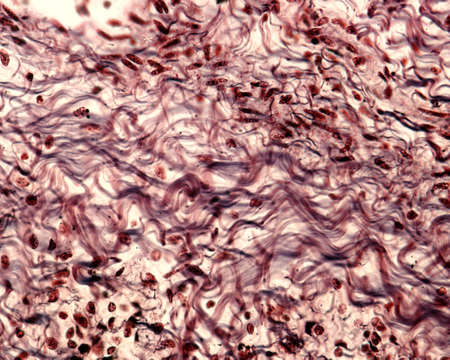 Bundles of collagen fibers in a connective tissue stained with a silver method.  The collagen fibers...