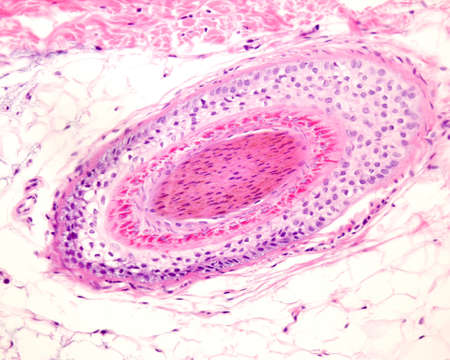 Layers of a human hair follicle in cross section. From outside: hyaline layer, outer root sheath, Henleâs and Huxleyâs layers, inner root sheath, and hair shaft in the center.の写真素材