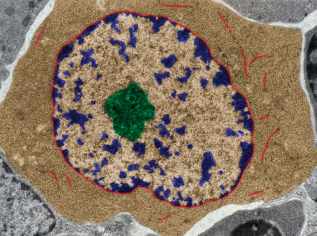 False colour transmission electron microscope (TEM) micrograph of a B-lymphocyte at the onset of its...
