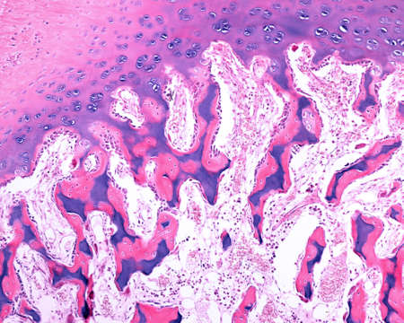 Mixed trabeculae generated in epiphyseal ossification.の写真素材