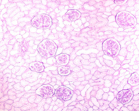 Section of human kidney stained with PAS (Periodic Acid-Schiff) to highlight the basement membranes...