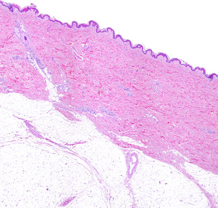 Low power light microscope micrograph of thin skin showing from top to bottom, the epidermis, a very thick dermis showing sweat glands, and the adipose tissue of the hypodermis. Hematoxylin-eosin.の写真素材