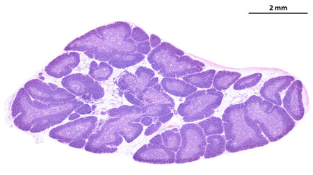 Low power light microscope micrograph of a human thymus gland stained with HE. The thymic parenchyma...