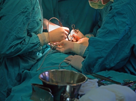Surgery treatment, team of doctors are operating a patientのeditorial素材