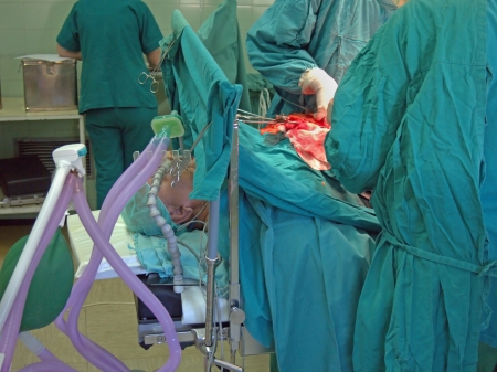 Surgery team are operating a patientのeditorial素材