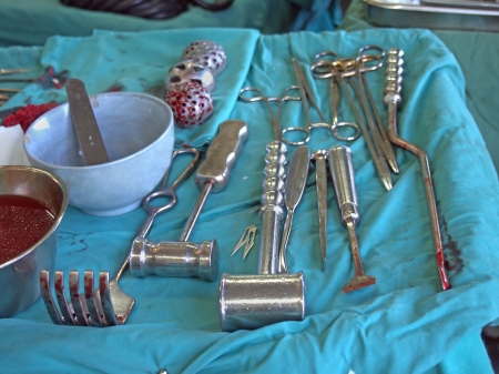 Surgery instruments at table, scissors,  tweezers,  gauze, hamer, cuterのeditorial素材