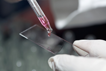 Hands with laboratory equipment - medical and chemical instrumentsの写真素材