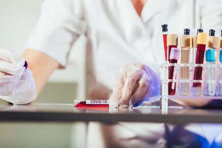 Lab technician assistant analyzing a blood sample in test tube at laboratory. Medical,...