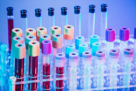 Test tubes. Medical equipment.Test tubes with colorful liquids in holder on table.の写真素材