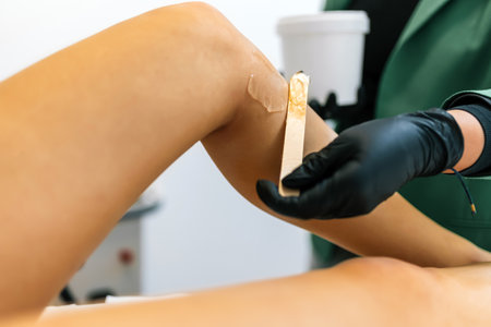 Beautician putting gel on clients leg for the laser hair removal.の写真素材