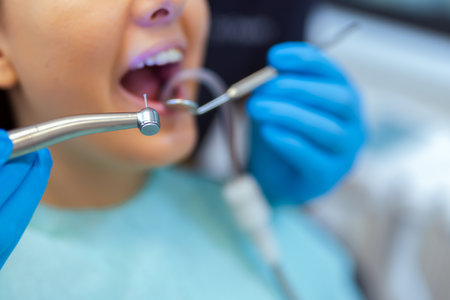 Male dentist performing dental treatment on female patient in modern clinic. Focus on professional care, precision, and oral health.の写真素材