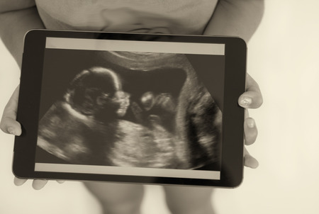 Baby holding tablet pc. Concept: Ultrasound image of baby in mother's womb. Isolated on white.の写真素材
