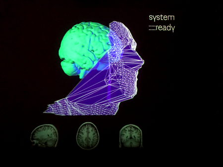 Magnetic resonance image of male human brain.