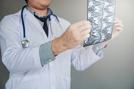 Doctor holding and checking chest x-ray film or roentgen image in ward hospitalの写真素材