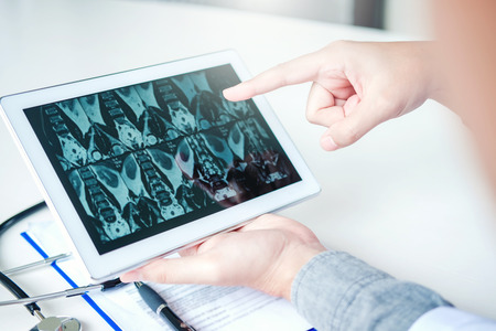 Doctor consulting with patient presenting x-ray film results on digital tablet tablet sitting at tableの写真素材