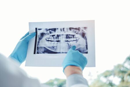 Dentist consulting with patient presenting results on Dental x-ray film About the problem of the patientの写真素材