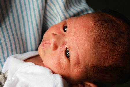 newborn baby is allergic to milk,there is rash on face.