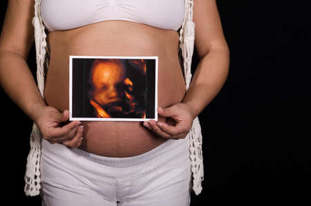 Photo shoot pregnant womanの写真素材