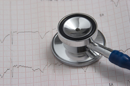 Stethoscope with electrocardiogram
