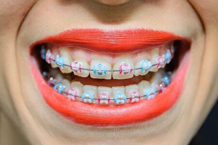 Dental Appointment treatment Orthodontics Healthの写真素材