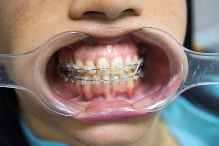 Dental Appointment treatment Orthodontics Healthの写真素材