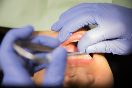 Dental Candy Lipstick Treatment Appointment