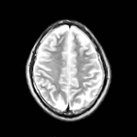 nuclear magnetic resonance image of skullの写真素材