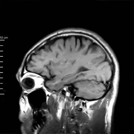 nuclear magnetic resonance image of skullの写真素材