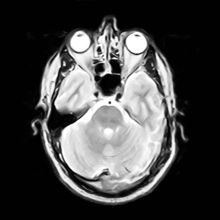 nuclear magnetic resonance image of skullの写真素材