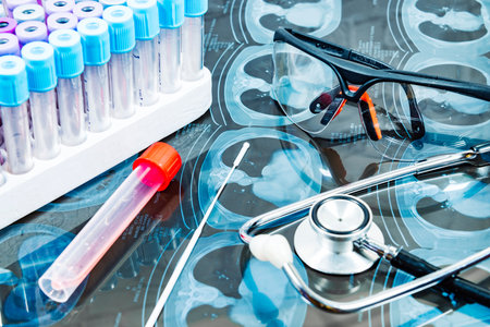 MAGNETIC RESONANCE FUND TOGETHER WITH A PCR CORONAVIRUS TEST AND A STETHOSCOPE SELECTIVE APPROACH.