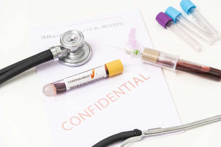 Close-up of positive blood sample from Coronavirus, covid 19.の写真素材