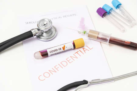 Close-up of positive blood sample from Coronavirus, covid 19.の写真素材