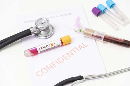 H10N3 bird flu test, blood sample tube for influenza A virus subtype H10N3 test.の写真素材