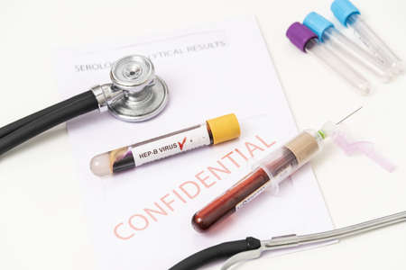 Blood sample positive with hepatitis B virus.の写真素材