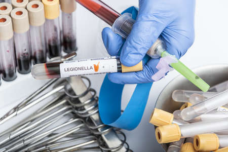 Scientists hand holding a test-tube with blood sample for LEGIONELLA test.の写真素材
