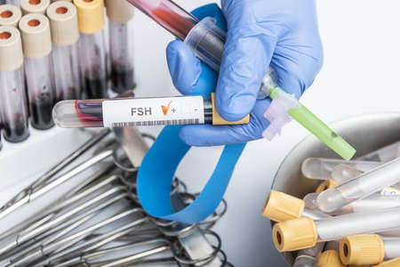 Test tube with blood sample for follicle stimulating hormone FSH test.の写真素材