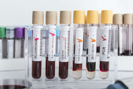 Blood samples of new variant OMICRON plus flu FLUORONE, covid19, coronavirus. Selective approach to the sample tube.の写真素材
