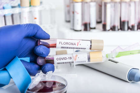 Doctors hands hold blood samples of the new variant omicron plus flu FLORONA, covid19, coronavirus. Selective approach to the sample tube.の写真素材