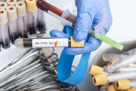 Scientists hand holding a test-tube with blood sample for HIV TYOE 1 AND 2 test.の写真素材