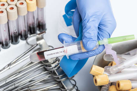 Scientists hand holding a test-tube with blood sample for NCOV19 delta variant test.の写真素材